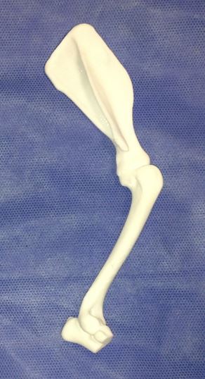 bone model created from the CT scan 